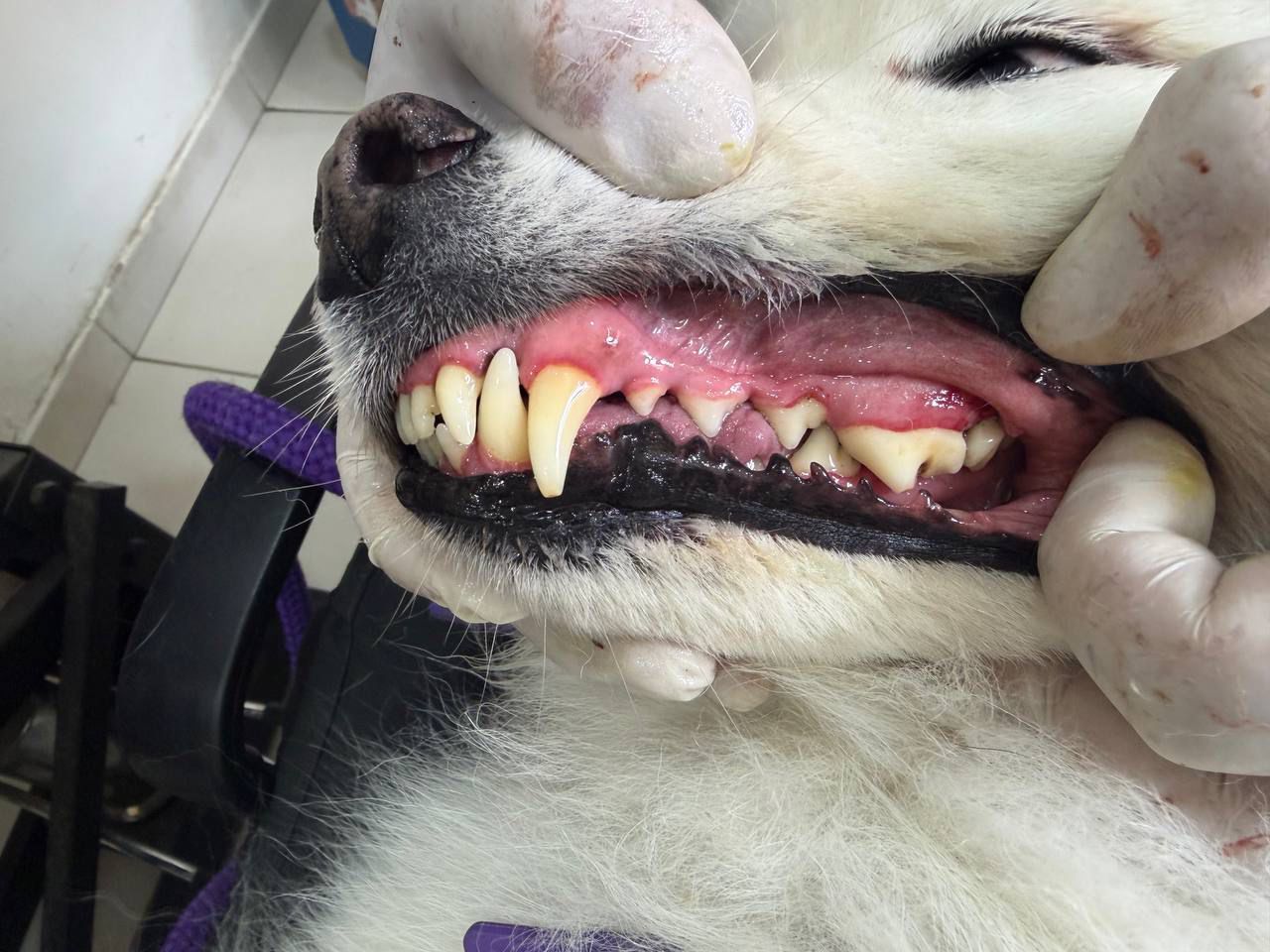 Profilaxis dental